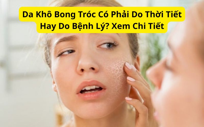 Da Khô Bong Tróc Có Phải Do Thời Tiết Hay Do Bệnh Lý? Xem Chi Tiết Da Khô Bong Tróc Có Phải Do Thời Tiết Hay Do Bệnh Lý? Xem Chi Tiết